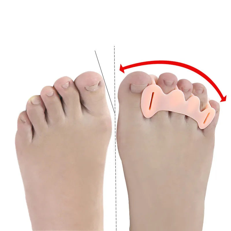 Gentle Toe Correctors™